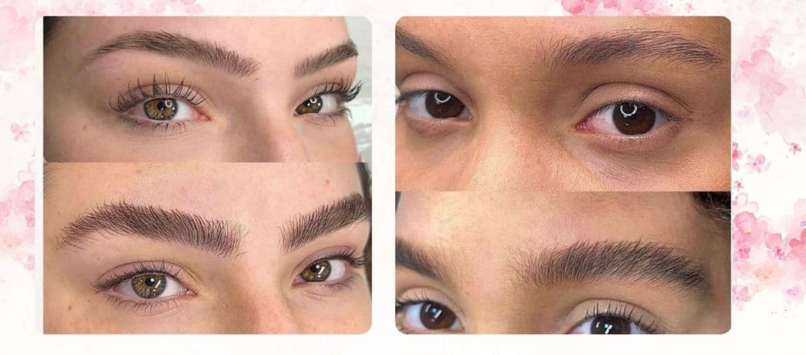 Protocolo de crescimento para sobrancelhas em Goiânia